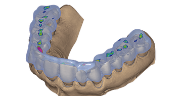 exocad Bite Splint (Perpetual Initial Purchase)